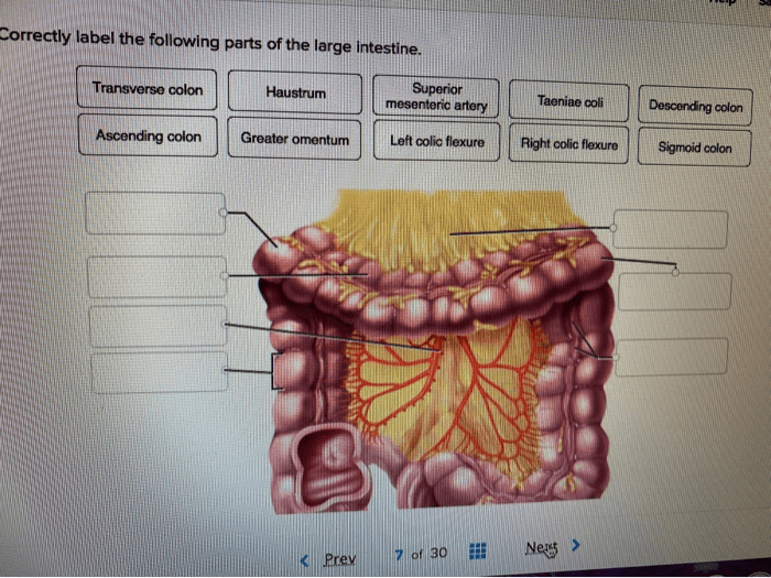 Correctly label the following parts of the large intestine